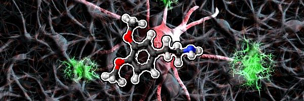 Avances en la lucha contra el Parkinson: Implante de neuronas dopaminérgicas